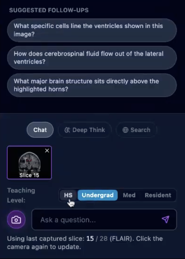 Adaptive follow-up questions based on the selected learning level