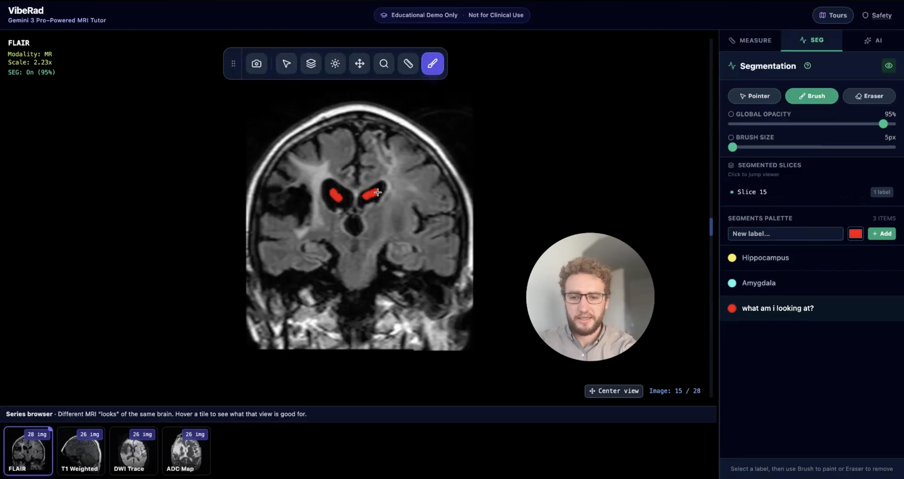 Segmentation panel with anatomical labels painted on an MRI slice